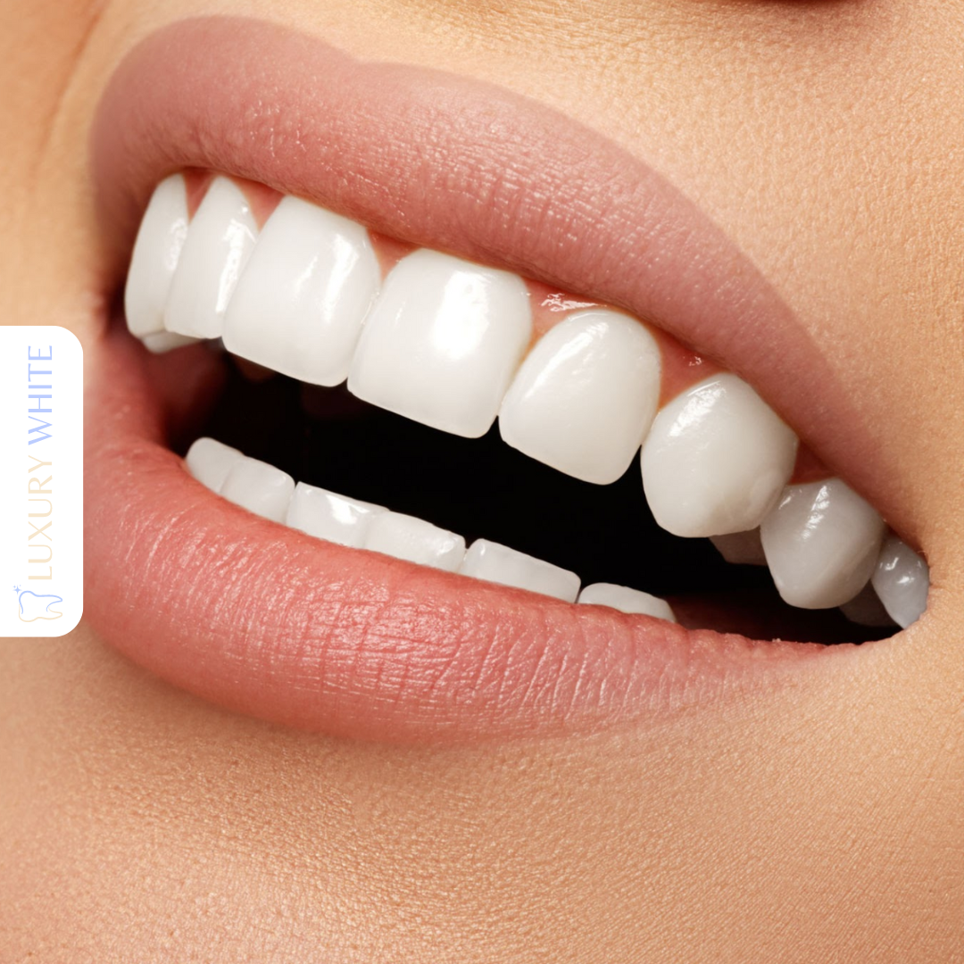 Comment avoir des dents plus blanches ? Encore plus blanc aujourd'hui — free download