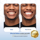 V34 X PAP+ Whitening Strips
